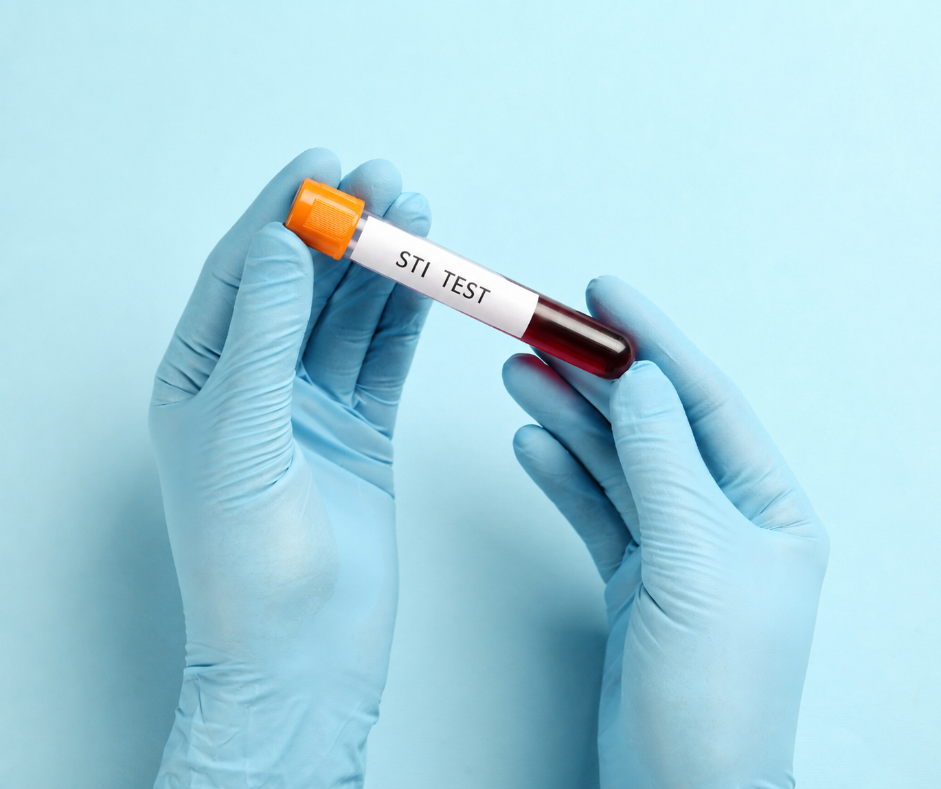 HIV, kiła i mogiła? Fakty o STI w 2026 roku